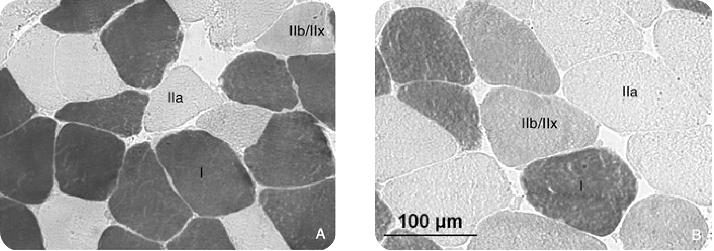 Figure 1. Muscle fiber type analyses